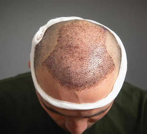 Hair Treatments