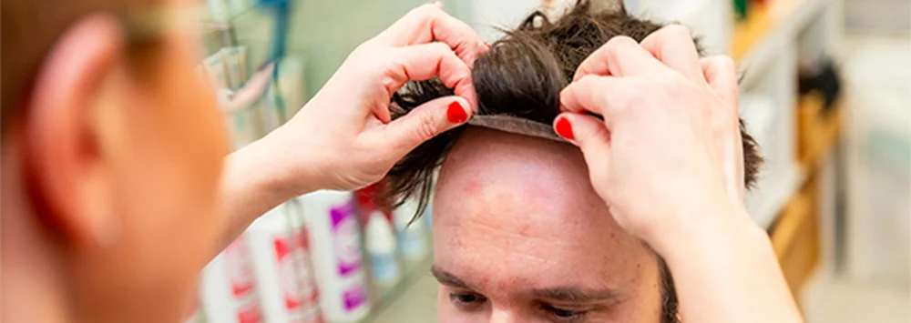 Hair Transplants vs Wigs