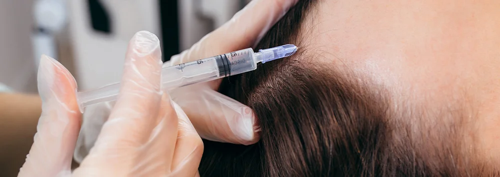 Hair Loss Treatment