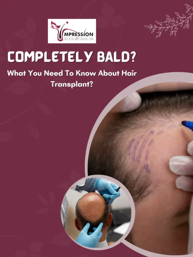 What You Need To Know About Hair Transplant