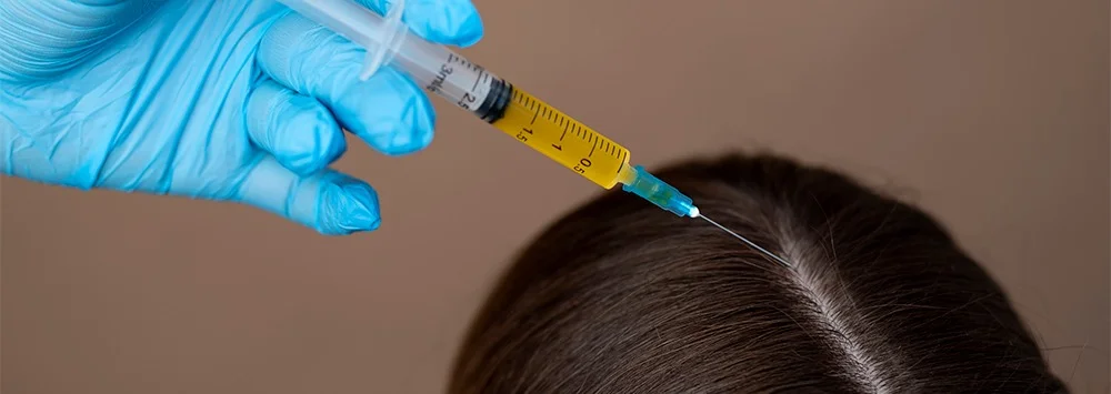 PRP Hair Treatments