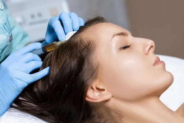 Mesotherapy For Hair