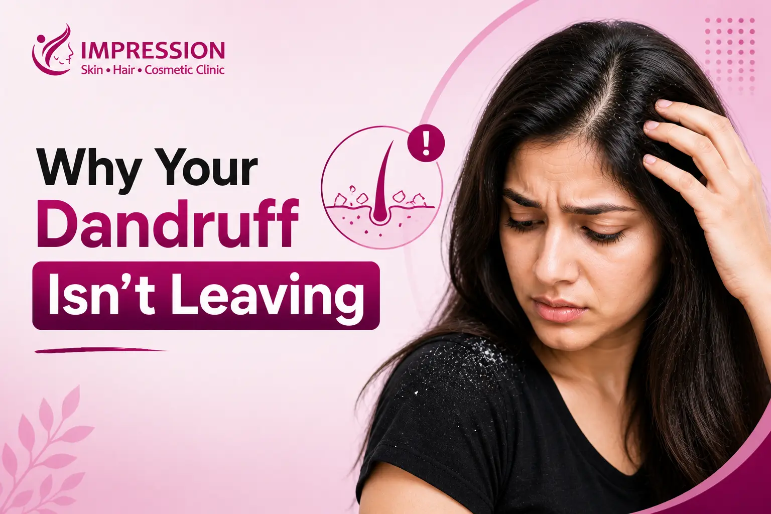Dandruff That Won’t Go Away What It’s Trying to Tell You